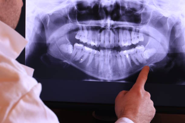 Best Emergency Denture Repair in Hudson, NC