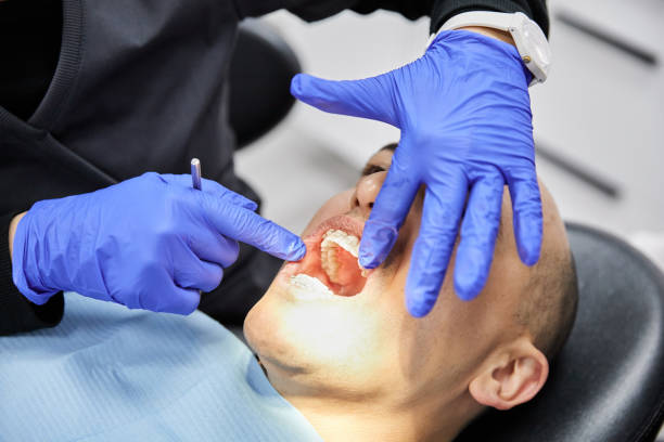 Best Emergency Dental Care for Broken or Chipped Teeth in Hudson, NC